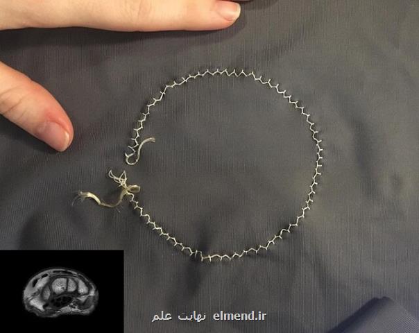 بهبود آزمایش ام آر آی با كمك یك ابزار پوشیدنی