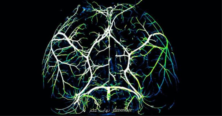 كشف مكانیسم مؤثر در مغز برای مبارزه با آلزایمر